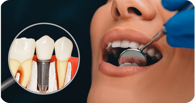 img-home-4-min img-home-4-min